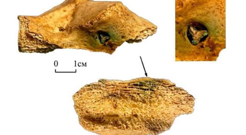 После ранения мужчина выжил. Но травма давала о себе знать. Фото с сайта pifk.magtu.ru