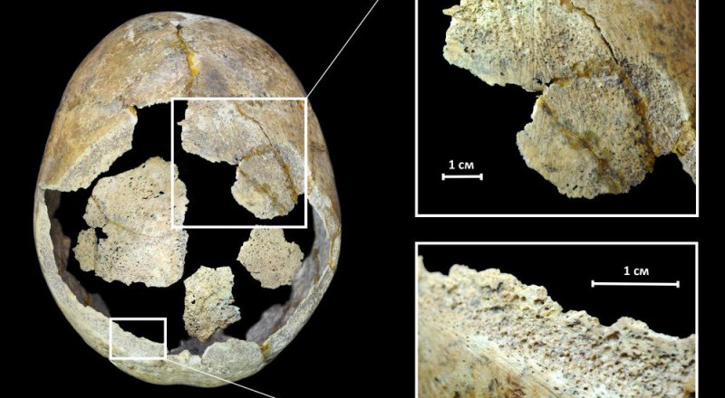 Предположительное расположение наиболее крупных костных пластинок в области трепанации черепа. Фото пресс-службы Института археологии РАН.